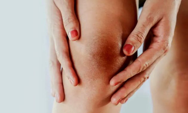 Cara memutihkan lutut dan siku yang gelap secara alami yang dijamin efektif