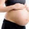 Artikel mengenai beberapa tips mencegah stretch mark untuk ibu hamil yang harus dilakukan untuk menjaga penampilan.
