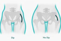 Artikel kali ini membahas mengenai apa itu hip dips atau lekukan pinggul dan mengapa tidak perlu diperbaiki karena itu normal.