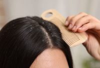 Artikel kali ini membahas mengenai beberapa penyebab rambut berketombe yang harus dihindari agar rambut bersih tanpa ketombe.